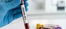 пробирка с кровью для анализа на витамин B12