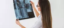 врач изучает рентген позвоночника